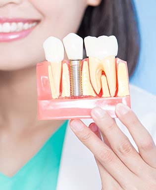 Implants Near Me in Camarillo, CA